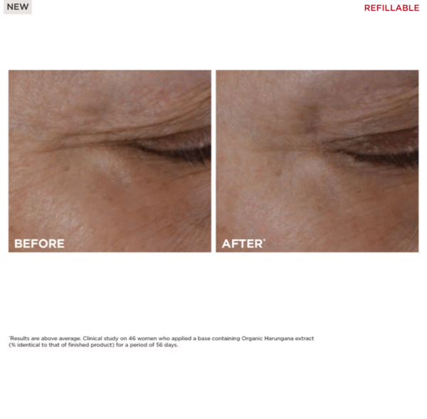 TOTAL EYE LIFT 15 ml